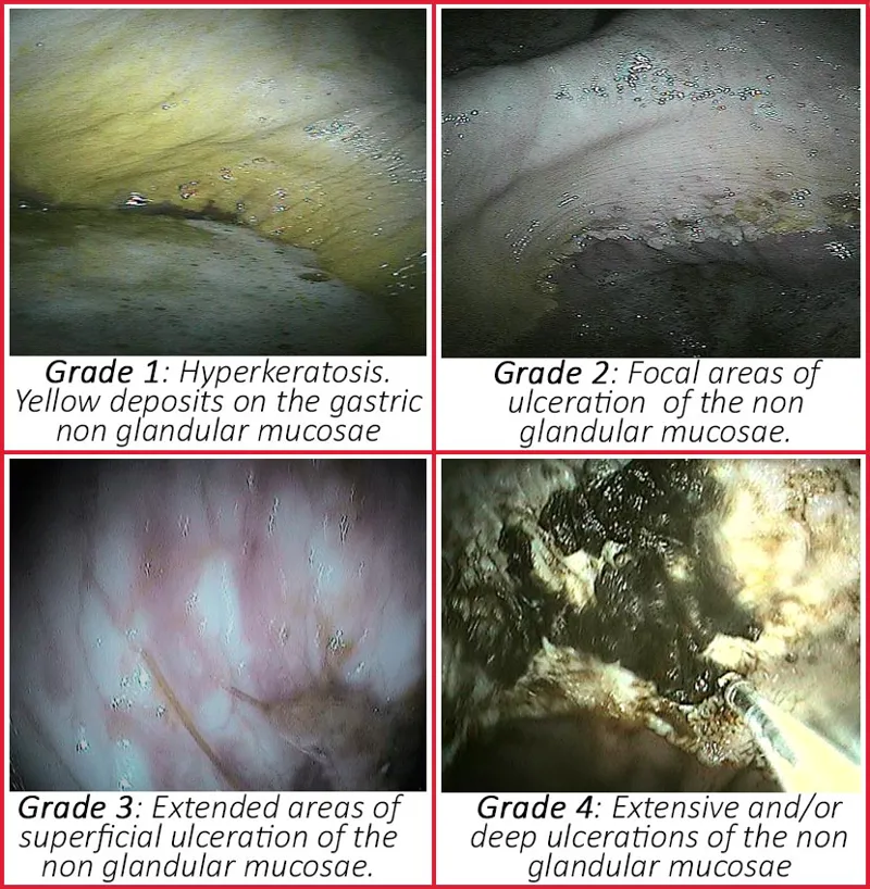 Kevin Bacons Stomach-Protek Speed Action-1