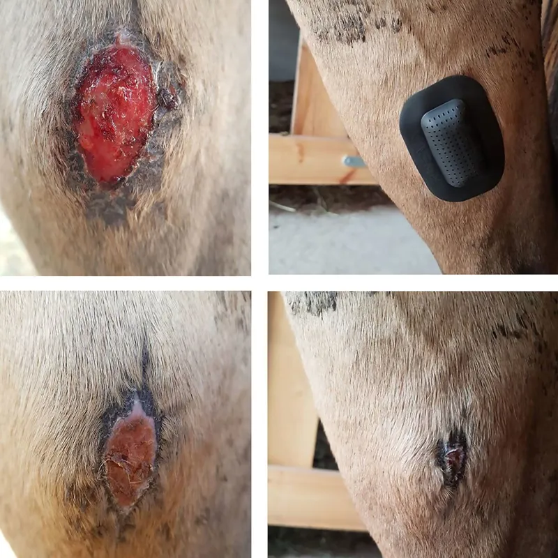 RHEVA Wound Protection Plaster-3